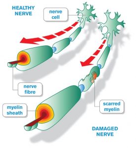 Diagram of myelin